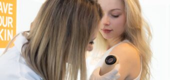 Стартира кампанията #SaveYourSkin с безплатни профилактични прегледи на бенки